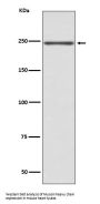 Anti-Myosin heavy chain MYH6 Rabbit Monoclonal Antibody