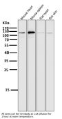 Anti-ERK5 Rabbit Monoclonal Antibody