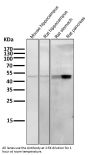 Anti-Cytokeratin 20 KRT20 Rabbit Monoclonal Antibody