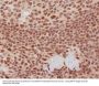 Anti-K63-linkage Specific Ubiquitin UBB Rabbit Monoclonal Antibody