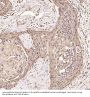 Anti-Ubiquitin UBB Rabbit Monoclonal Antibody