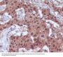 Anti-Ubiquitin UBB Rabbit Monoclonal Antibody