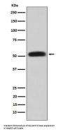 Anti-Glycerol kinase Rabbit Monoclonal Antibody