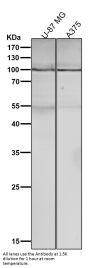 Anti-GluR2 Monoclonal Antibody