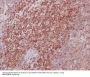 Anti-MEK3/MEK6 MAP2K3 Rabbit Monoclonal Antibody