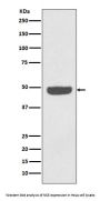 Anti-NSE ENO2 Rabbit Monoclonal Antibody