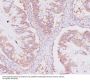 Anti-NSE ENO2 Rabbit Monoclonal Antibody