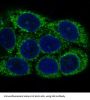 Anti-NSE ENO2 Rabbit Monoclonal Antibody