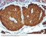 Anti-NSE gamma (Neuron Specific Enolase, gamma) (Neuroendocrine Marker) ENO2 Monoclonal Antibody