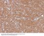 Anti-NSE gamma (Neuron Specific Enolase, gamma) (Neuroendocrine Marker) ENO2 Monoclonal Antibody