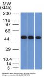 Anti-NSE gamma (Neuron Specific Enolase, gamma) (Neuroendocrine Marker) ENO2 Monoclonal Antibody