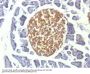 Anti-NSE gamma (Neuron Specific Enolase, gamma) (Neuroendocrine Marker) ENO2 Monoclonal Antibody
