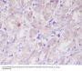 Anti-ILK/Integrin Linked Ilk Rabbit Monoclonal Antibody