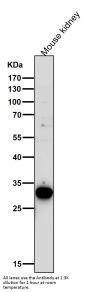 Anti-GCLM Monoclonal Antibody