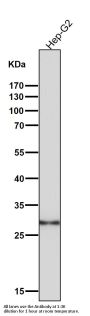 Anti-GCLM Monoclonal Antibody