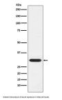 Anti-GCLM Monoclonal Antibody
