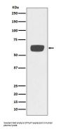 Anti-PLAT/Tpa Rabbit Monoclonal Antibody