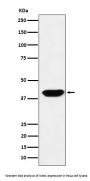 Anti-Islet1 Monoclonal Antibody