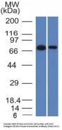 Anti-Endoglin / CD105 (Angiogenesis Marker) ENG Monoclonal Antibody