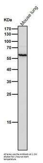 Anti-Calcineurin A Rabbit Monoclonal Antibody