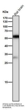 Anti-Calcineurin A Rabbit Monoclonal Antibody