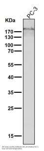 Anti-Collagen XVII Rabbit Monoclonal Antibody