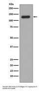 Anti-Collagen XVII Rabbit Monoclonal Antibody