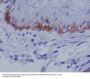 Anti-Collagen XVII Rabbit Monoclonal Antibody