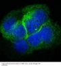 Anti-Collagen XVII Rabbit Monoclonal Antibody