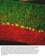 Anti-Calbindin Antibody