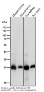Anti-Calbindin CALB1 Rabbit Monoclonal Antibody