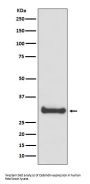 Anti-Calbindin CALB1 Rabbit Monoclonal Antibody
