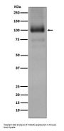 Anti-mGluR1 GRM1 Rabbit Monoclonal Antibody