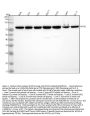 Anti-MTA2 Monoclonal Antibody