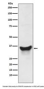 Anti-BNIP3L/Nix Rabbit Monoclonal Antibody