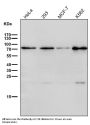 Anti-BDKRB2 Monoclonal Antibody