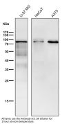 Anti-BDKRB2 Monoclonal Antibody