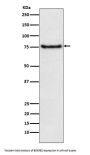 Anti-BDKRB2 Monoclonal Antibody