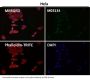 Anti-Clathrin heavy chain Rabbit Monoclonal Antibody