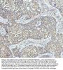 Anti-Clathrin heavy chain Rabbit Monoclonal Antibody