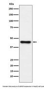 Anti-ABHD5 Monoclonal Antibody