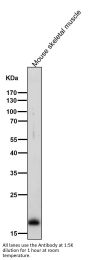 Anti-Myosin Light Chain 2 Rabbit Monoclonal Antibody