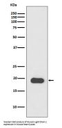 Anti-Myosin Light Chain 2 Rabbit Monoclonal Antibody