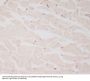 Anti-Myosin Light Chain 2 Rabbit Monoclonal Antibody