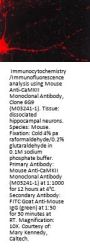 Anti-CaMKII (Alpha-Specific) Monoclonal Antibody