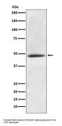 Anti-CaMKII alpha CAMK2A Rabbit Monoclonal Antibody