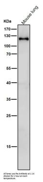 Anti-SPINK5 / LEKTI Rabbit Monoclonal Antibody