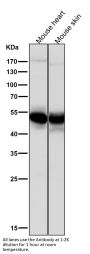 Anti-GLUT3 SLC2A3 Rabbit Monoclonal Antibody