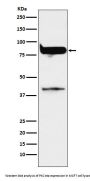 Anti-PKC eta Rabbit Monoclonal Antibody