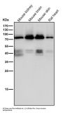 Anti-PKC eta Rabbit Monoclonal Antibody